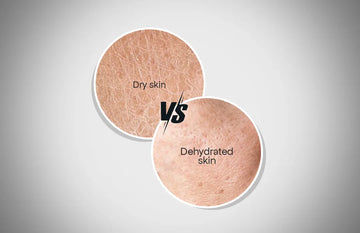 Dry-skin-vs-Dehydrated-skin-Difference-Between-Dry-and-Dehydrated-Skin