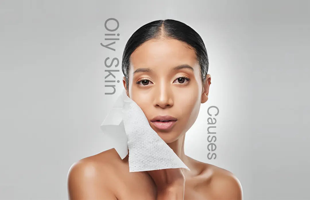 Oily-Skin-Reasons-What-Causes-Oily-Skin 